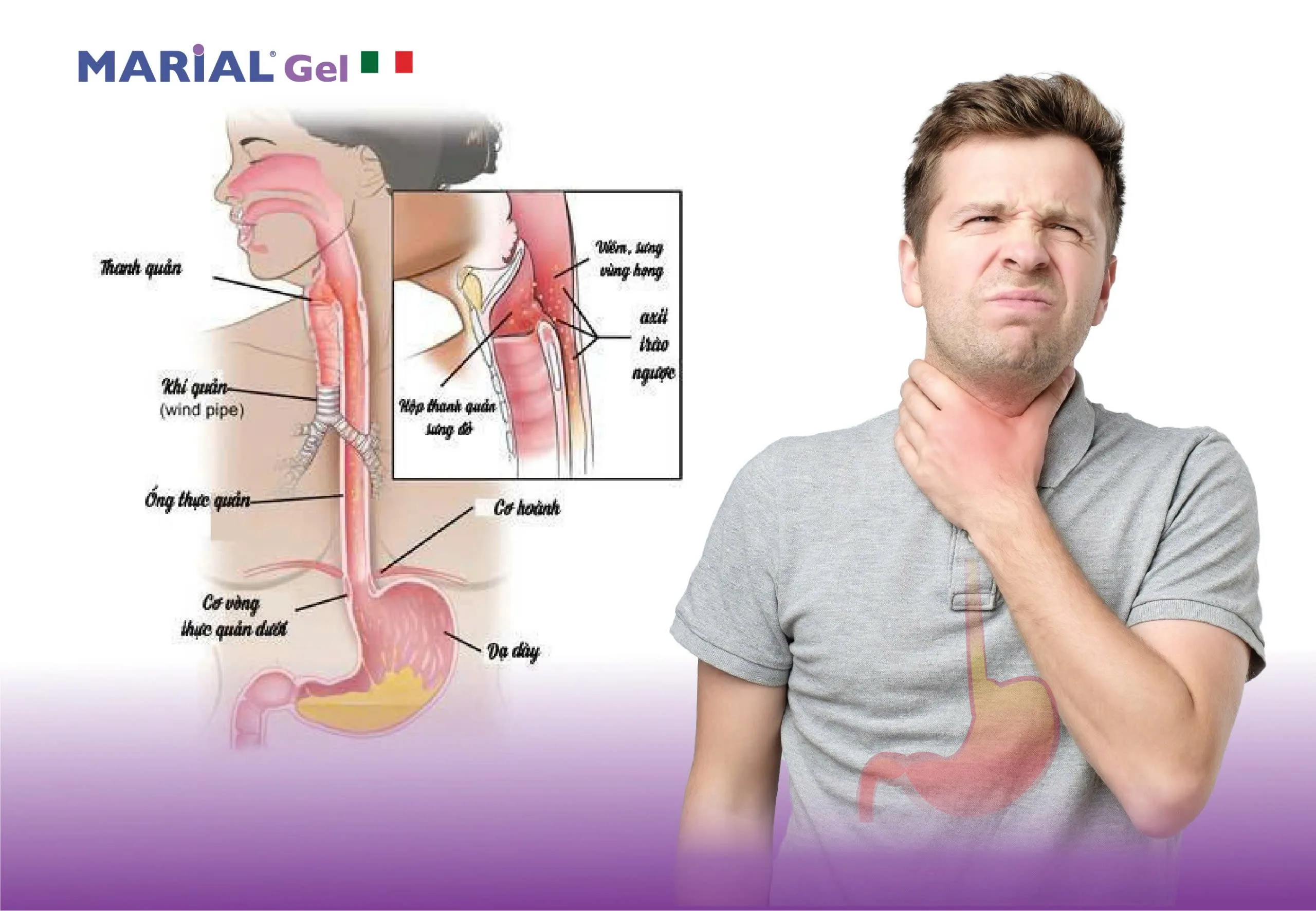 Lý do trào ngược họng thanh quản khó điều trị dứt điểm